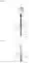 Fig. 02 - OSSEOUS ANCHORING IMPLANT WITH CORTICAL STABILIZATION