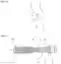 Fig. 09 - OSSEOUS ANCHORING IMPLANT WITH CORTICAL STABILIZATION