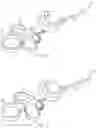 Fig. 04 - ARTICULATED ENDOSCOPIC INSTRUMENT
