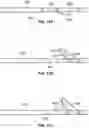 Fig. 10 - SYSTEMS FOR IMPROVING THE APPEARANCE OF TISSUE