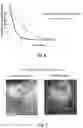 Fig. 08 - ELECTRODE ARRANGEMENT IN A CARDIAC ABLATION CATHETER AND METHODS FOR USE
