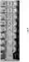 Fig. 09 - ELECTRODE ARRANGEMENT IN A CARDIAC ABLATION CATHETER AND METHODS FOR USE