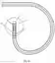 Fig. 14 - Medical device having a support structure