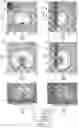 Fig. 07 - High-efficiency, directional microwave ablation antenna