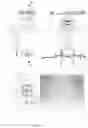 Fig. 10 - DEVICE, SYSTEM AND METHOD FOR REMOVAL OF HAIR