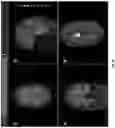 Fig. 06 - SYSTEMS AND METHODS FOR PLANNING AND SIMULATION OF MINIMALLY INVASIVE THERAPY