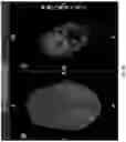 Fig. 08 - SYSTEMS AND METHODS FOR PLANNING AND SIMULATION OF MINIMALLY INVASIVE THERAPY