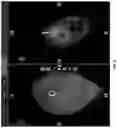 Fig. 10 - SYSTEMS AND METHODS FOR PLANNING AND SIMULATION OF MINIMALLY INVASIVE THERAPY