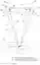 Fig. 03 - Enhanced augmented reality headset for medical imaging