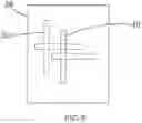 Fig. 07 - Enhanced augmented reality headset for medical imaging