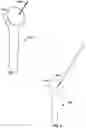 Fig. 08 - VIRTUAL GUIDANCE FOR CORRECTING SURGICAL PIN INSTALLATION