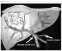 Fig. 02 - Robot for vascular intervention