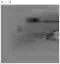 Fig. 05 - Robot for vascular intervention