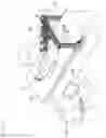 Fig. 06 - Robot for vascular intervention