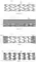 Fig. 02 - Stent-containing medical devices and methods of using the same