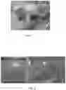 Fig. 06 - METHOD AND SYSTEM FOR PRODUCTION OF ANTI-MICROBIAL ORTHODONTIC ELASTOMERIC LIGATURES