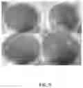 Fig. 07 - METHOD AND SYSTEM FOR PRODUCTION OF ANTI-MICROBIAL ORTHODONTIC ELASTOMERIC LIGATURES