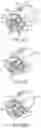 Fig. 35 - MEDICATION DELIVERY DEVICE WITH NEEDLE CARRIER
