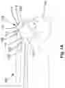 Fig. 02 - VENTILATED INTUBATION METHOD AND APPARATUS