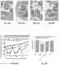 Fig. 16 - A COMBINATION OF PLASMA IMMUNOGLOBULIN AND ANTIGEN-SPECIFIC IMMUNOGLOBULIN FOR THE MODIFICATION OF THE IMMUNE SYSTEM AND THE TREATMENT OR PREVENTION OF AUTOIMMUNE DISEASES