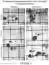 Fig. 02 - Lymphocyte-Based Morphometric Test for Alzheimer's Disease