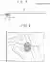 Fig. 04 - Camera module with foreign objects inhibiting structure