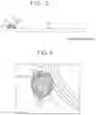Fig. 05 - Camera module with foreign objects inhibiting structure