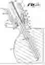 Fig. 05 - Pivotal bone anchor assembly with preloaded articulating retainer and bottom loaded shank