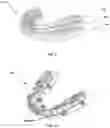 Fig. 03 - ELASTIC ORTHODONTIC APPLIANCES, SYSTEMS, AND METHODS FOR USE