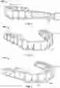 Fig. 06 - ELASTIC ORTHODONTIC APPLIANCES, SYSTEMS, AND METHODS FOR USE