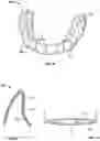 Fig. 07 - ELASTIC ORTHODONTIC APPLIANCES, SYSTEMS, AND METHODS FOR USE