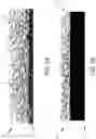 Fig. 02 - METHODS AND SYSTEMS FOR IMPLANTABLE MEDICAL DEVICES AND VASCULARIZATION MEMBRANES