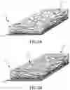 Fig. 03 - METHODS AND SYSTEMS FOR IMPLANTABLE MEDICAL DEVICES AND VASCULARIZATION MEMBRANES