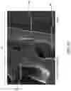 Fig. 13 - METHODS AND SYSTEMS FOR IMPLANTABLE MEDICAL DEVICES AND VASCULARIZATION MEMBRANES