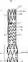 Fig. 01 - SEGMENTED COVERED STENT AND PREPARATION METHOD THEREFOR
