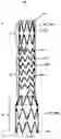 Fig. 02 - SEGMENTED COVERED STENT AND PREPARATION METHOD THEREFOR