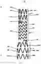 Fig. 04 - SEGMENTED COVERED STENT AND PREPARATION METHOD THEREFOR