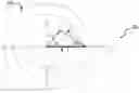 Fig. 01 - METHODS FOR SELECTING INTRAOCULAR LENSES AND RELAXING INCISIONS FOR CORRECTING REFRACTIVE ERROR
