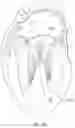 Fig. 37 - Coaptation enhancement implant, system, and method
