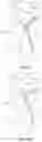 Fig. 44 - Coaptation enhancement implant, system, and method