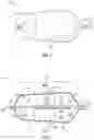 Fig. 02 - DILATION DEVICES, SYSTEMS, AND METHODS FOR IMPLANTS
