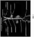 Fig. 02 - Heart valve delivery system and method with rotational alignment