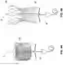 Fig. 05 - Heart valve delivery system and method with rotational alignment