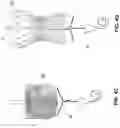 Fig. 06 - Heart valve delivery system and method with rotational alignment