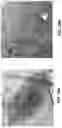 Fig. 12 - Heart valve delivery system and method with rotational alignment