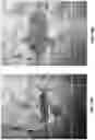 Fig. 15 - Heart valve delivery system and method with rotational alignment