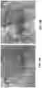 Fig. 16 - Heart valve delivery system and method with rotational alignment