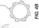 Fig. 06 - Implant delivery capsule