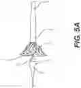 Fig. 07 - Implant delivery capsule