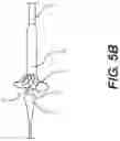 Fig. 08 - Implant delivery capsule
